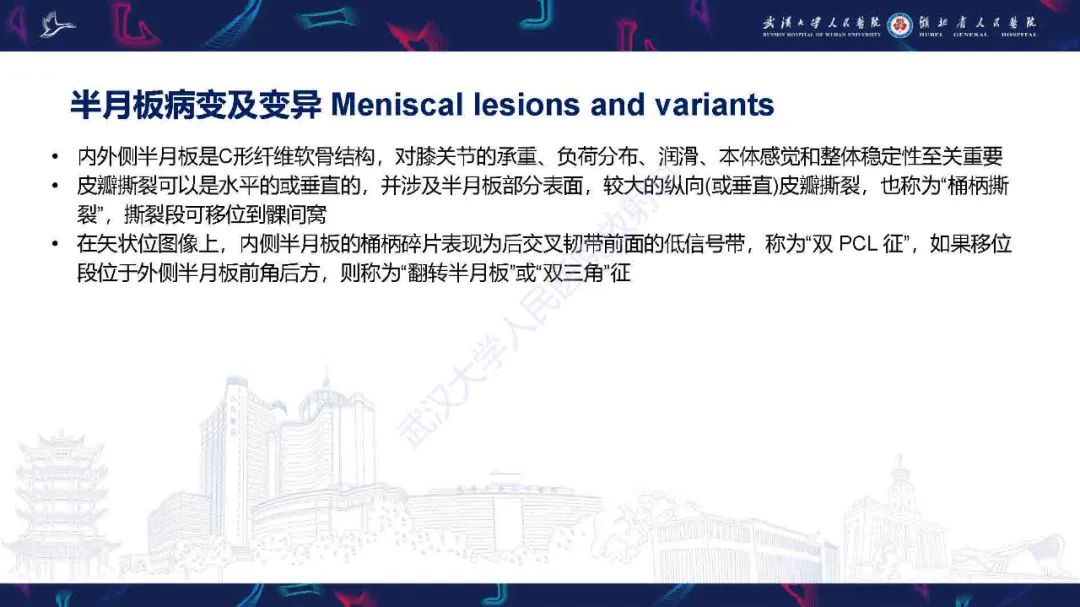 影像PPT - 【PPT】膝关节T2WI低信号病变影像诊断-8
