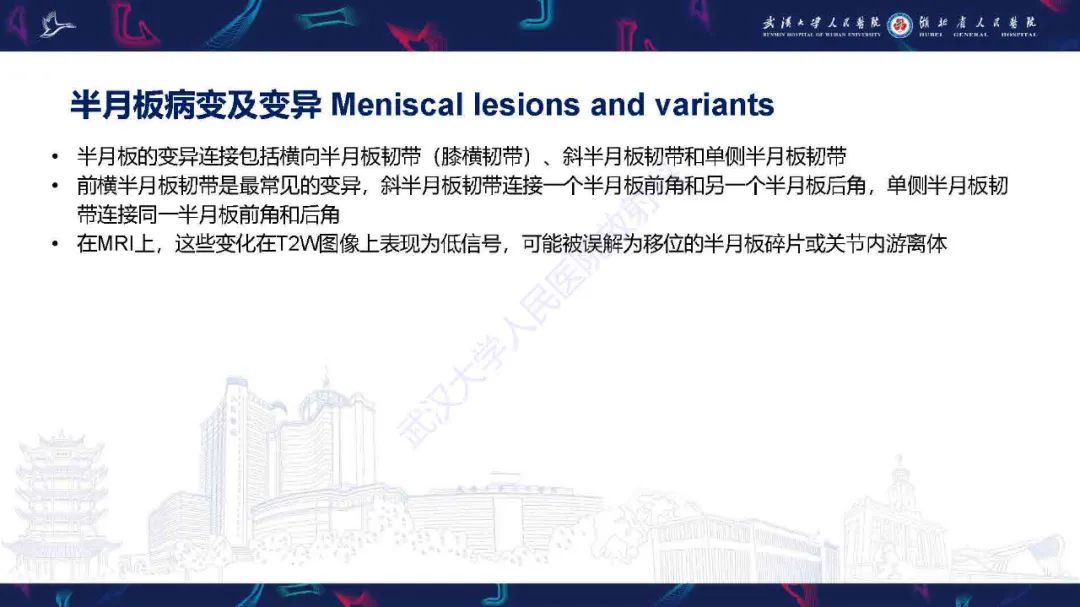 影像PPT - 【PPT】膝关节T2WI低信号病变影像诊断-10