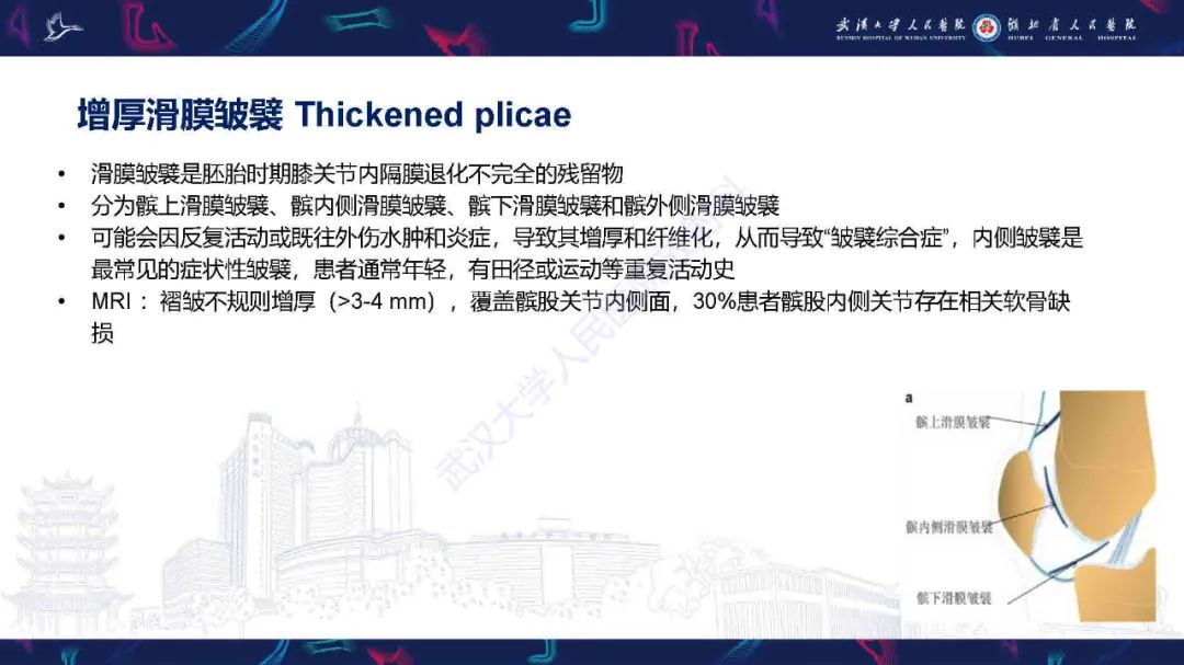 影像PPT - 【PPT】膝关节T2WI低信号病变影像诊断-31