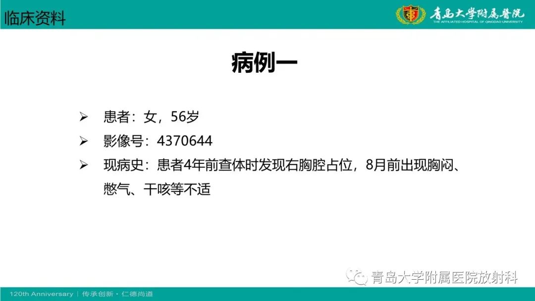 影像PPT - 【PPT】胸膜孤立性纤维性肿瘤-2