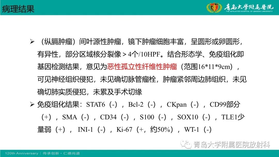 影像PPT - 【PPT】胸膜孤立性纤维性肿瘤-9
