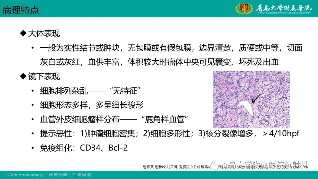 影像PPT - 【PPT】胸膜孤立性纤维性肿瘤-19