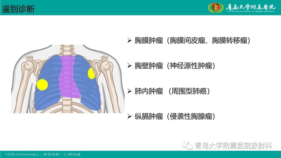 影像PPT - 【PPT】胸膜孤立性纤维性肿瘤-25