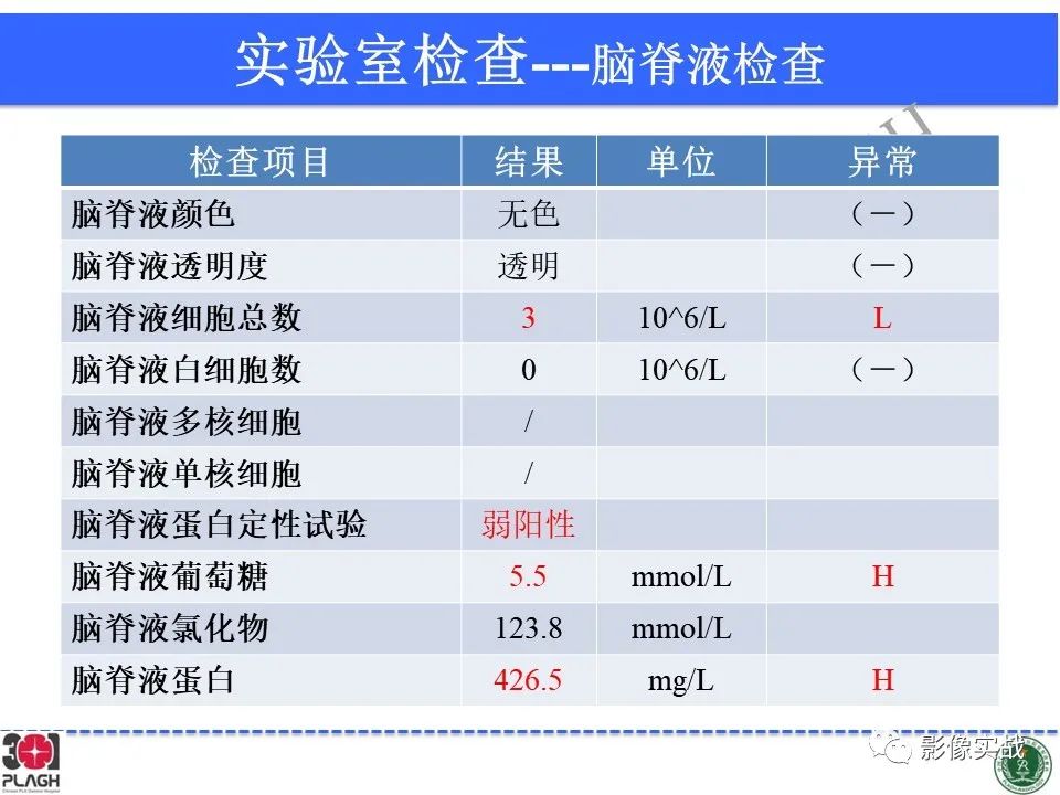 影像PPT - 【病例】胶质母细胞瘤1例MR影像-3