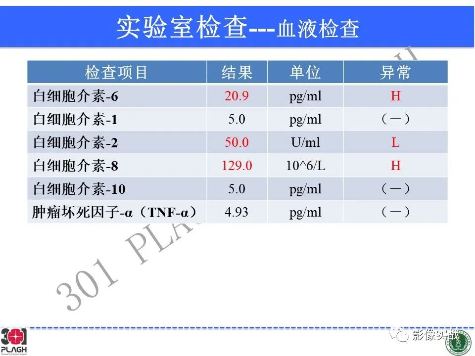 影像PPT - 【病例】胶质母细胞瘤1例MR影像-4