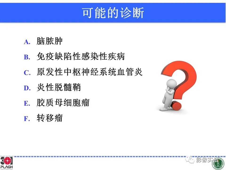 影像PPT - 【病例】胶质母细胞瘤1例MR影像-19
