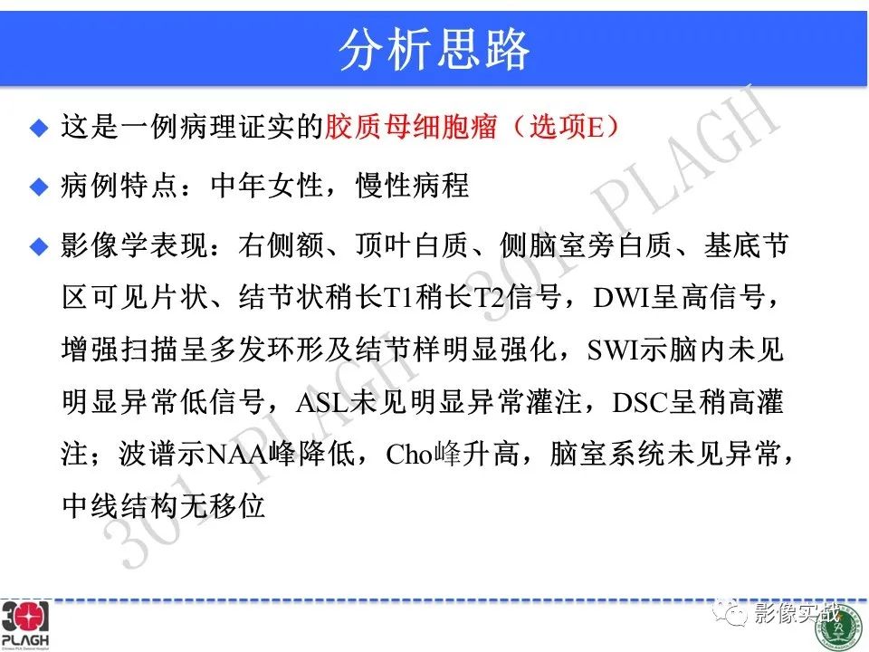 影像PPT - 【病例】胶质母细胞瘤1例MR影像-20