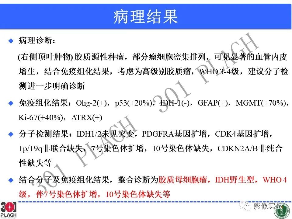 影像PPT - 【病例】胶质母细胞瘤1例MR影像-26