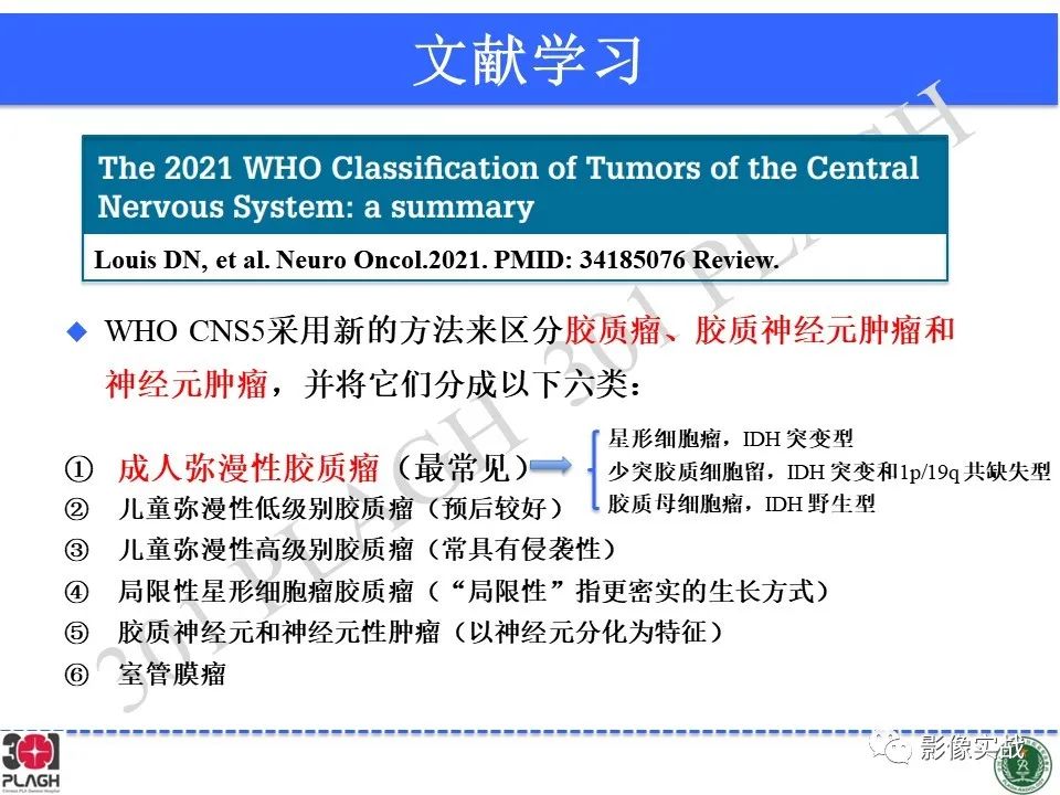 影像PPT - 【病例】胶质母细胞瘤1例MR影像-27