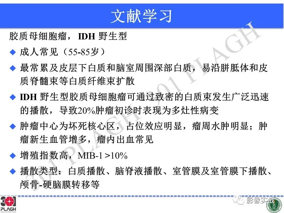 影像PPT - 【病例】胶质母细胞瘤1例MR影像-28