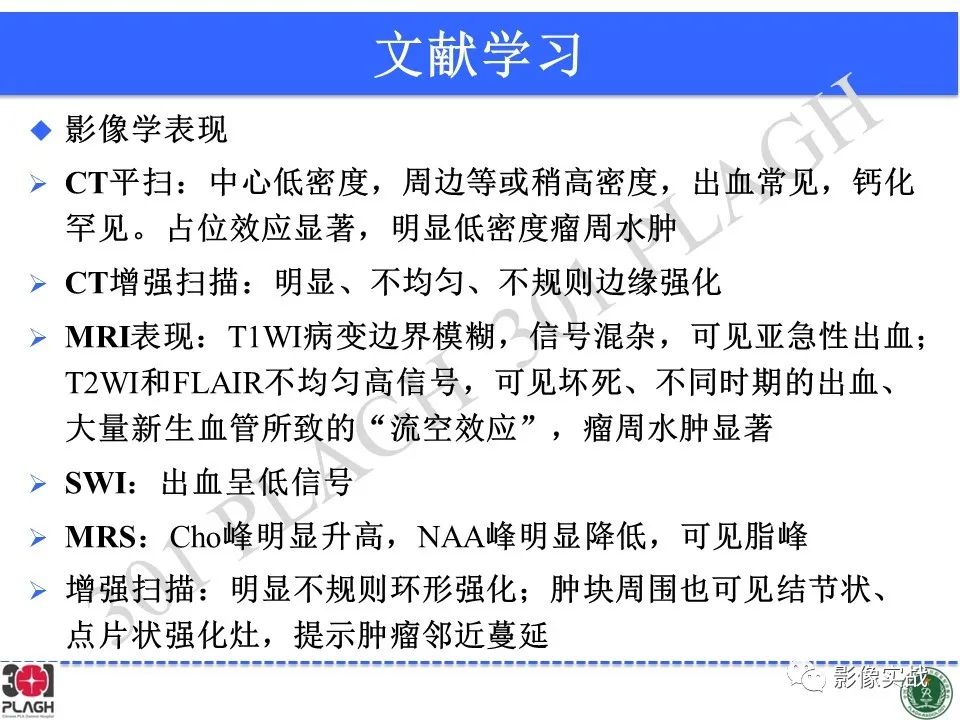 影像PPT - 【病例】胶质母细胞瘤1例MR影像-29