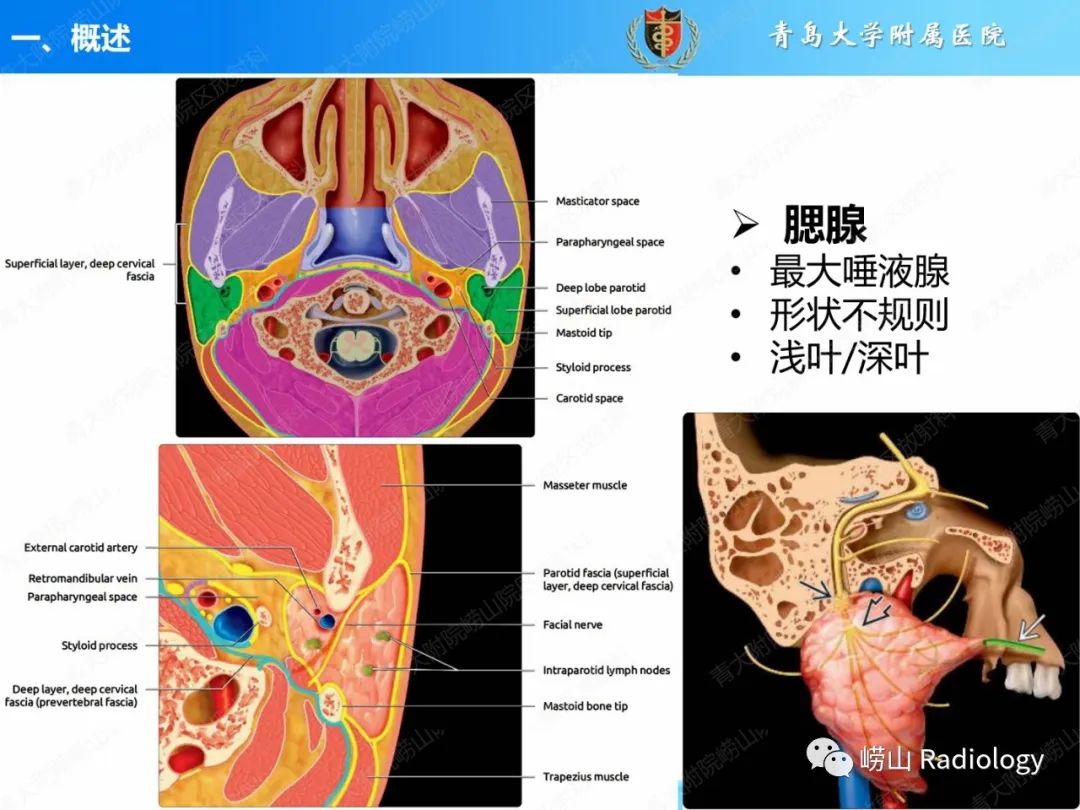 影像PPT - 【PPT】腮腺肿瘤性病变的影像学诊断思路及功能MRI价值评估-3