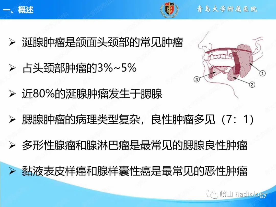 影像PPT - 【PPT】腮腺肿瘤性病变的影像学诊断思路及功能MRI价值评估-4