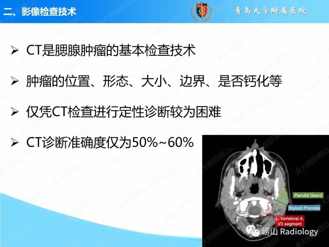 影像PPT - 【PPT】腮腺肿瘤性病变的影像学诊断思路及功能MRI价值评估-6