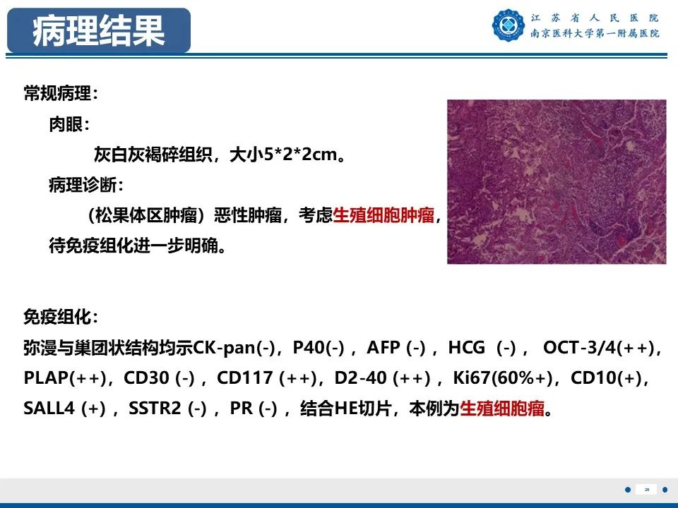 影像PPT - 【PPT】松果体生殖细胞瘤-27