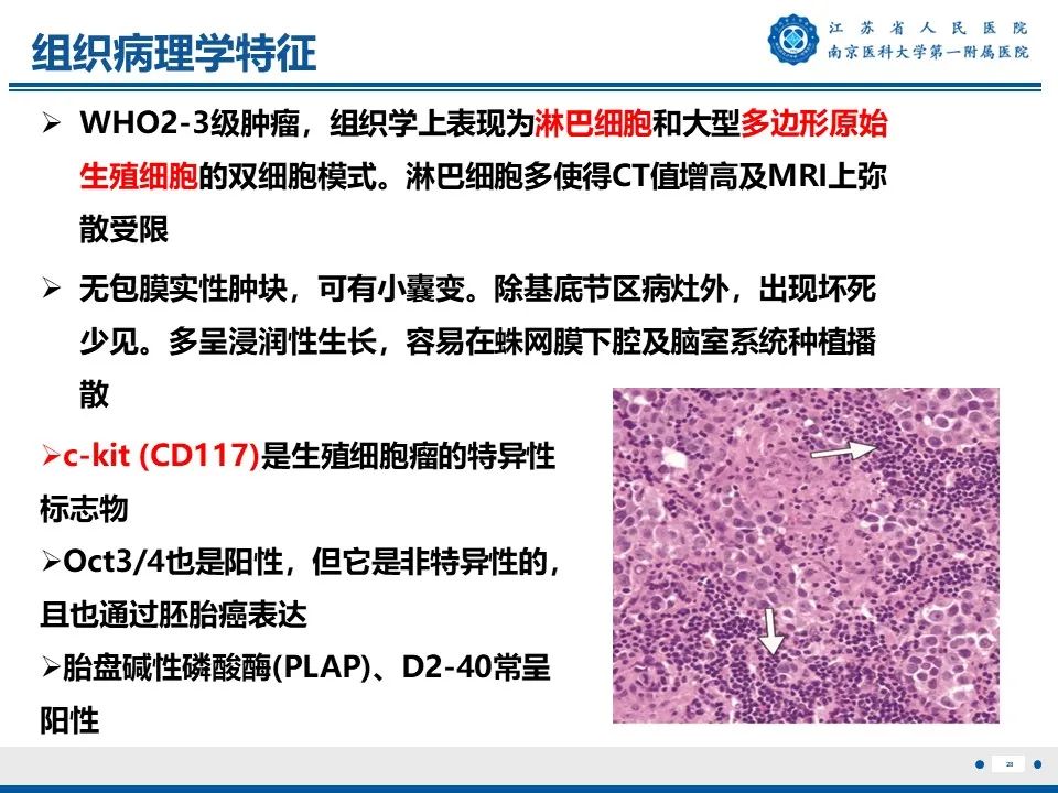 影像PPT - 【PPT】松果体生殖细胞瘤-29