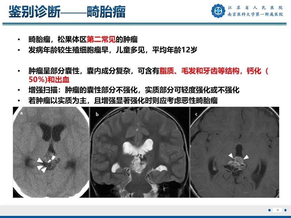 影像PPT - 【PPT】松果体生殖细胞瘤-40