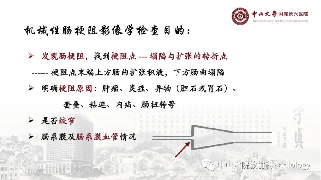 影像PPT - 【PPT】消化道急腹症的影像学诊断思路-13