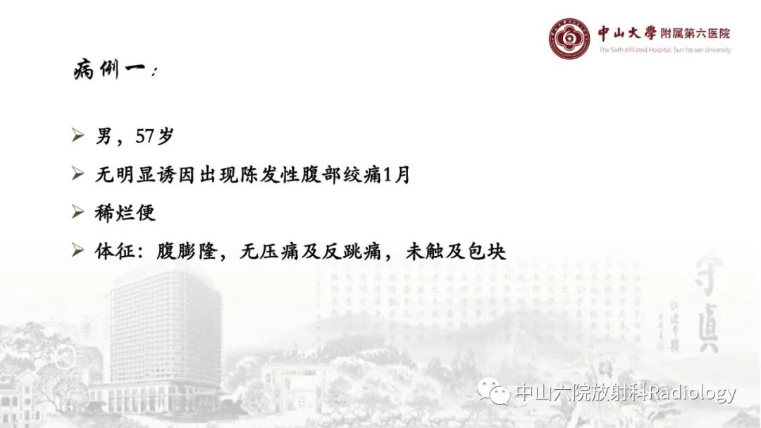 影像PPT - 【PPT】消化道急腹症的影像学诊断思路-15