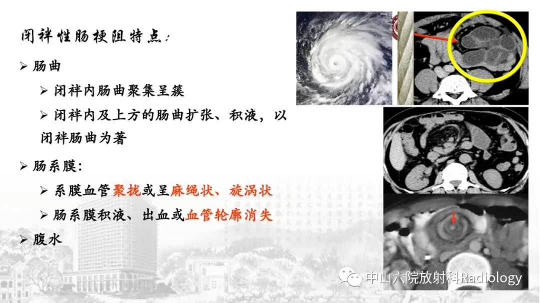 影像PPT - 【PPT】消化道急腹症的影像学诊断思路-27