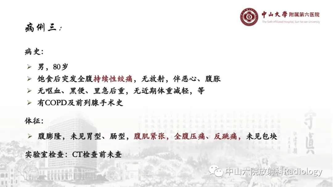 影像PPT - 【PPT】消化道急腹症的影像学诊断思路-28