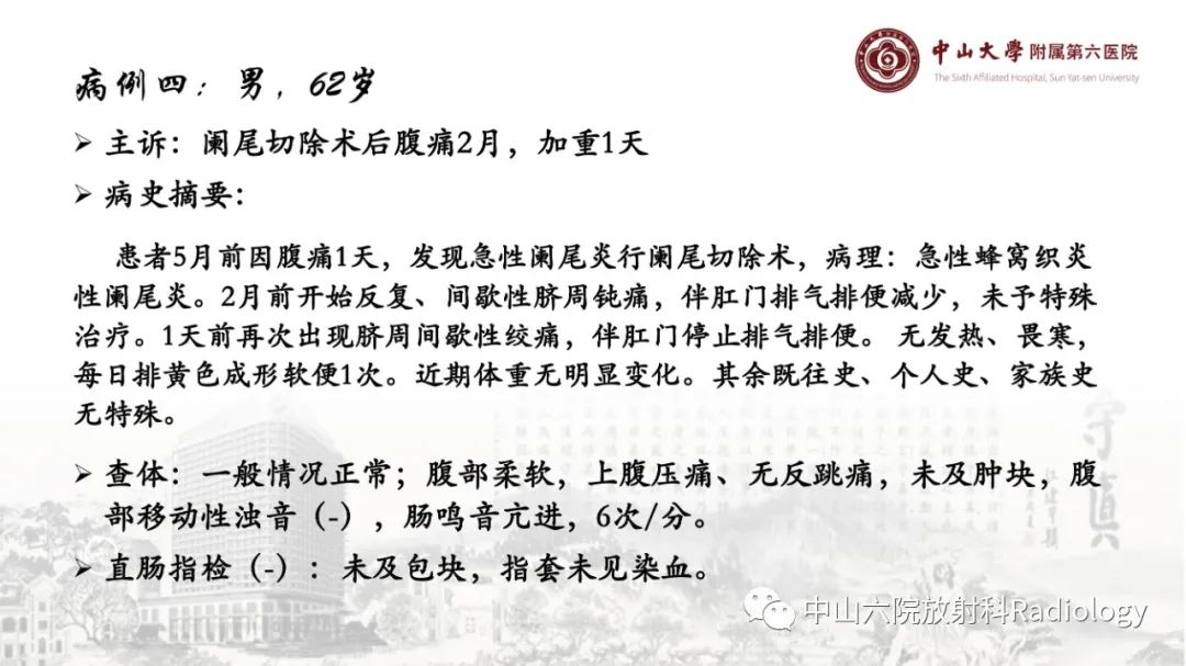 影像PPT - 【PPT】消化道急腹症的影像学诊断思路-40