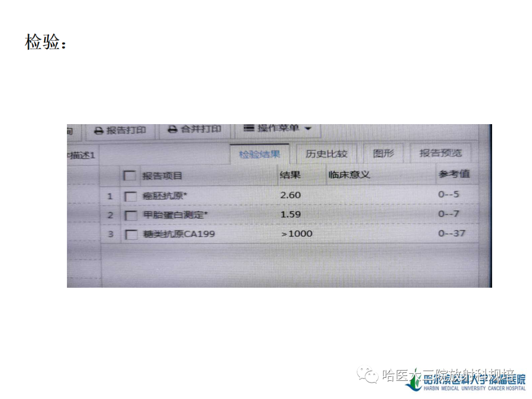 影像PPT - 【PPT】肝内胆管细胞癌-5