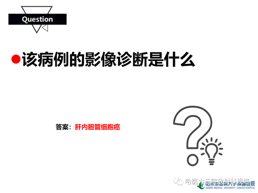影像PPT - 【PPT】肝内胆管细胞癌-6