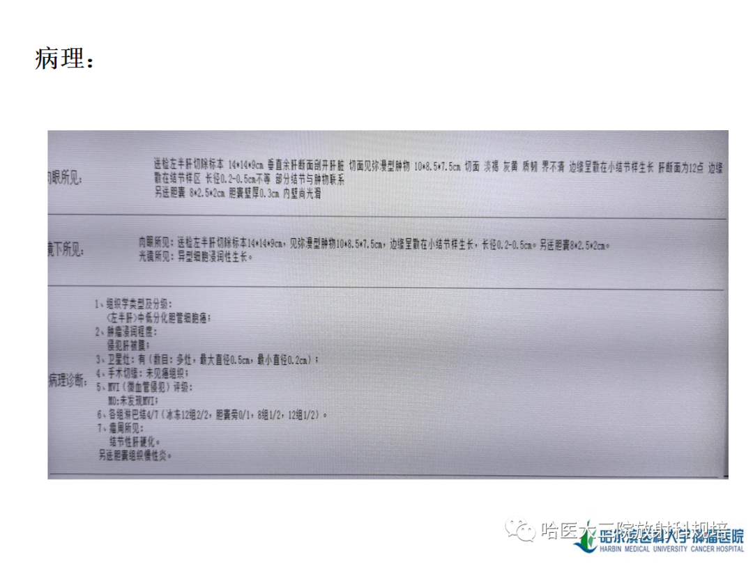 影像PPT - 【PPT】肝内胆管细胞癌-7