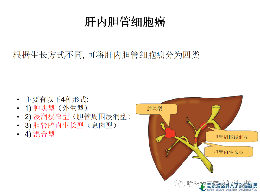 影像PPT - 【PPT】肝内胆管细胞癌-12