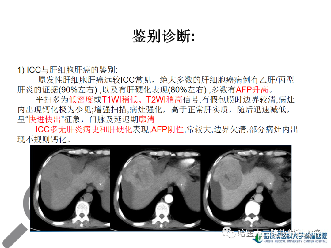 影像PPT - 【PPT】肝内胆管细胞癌-24