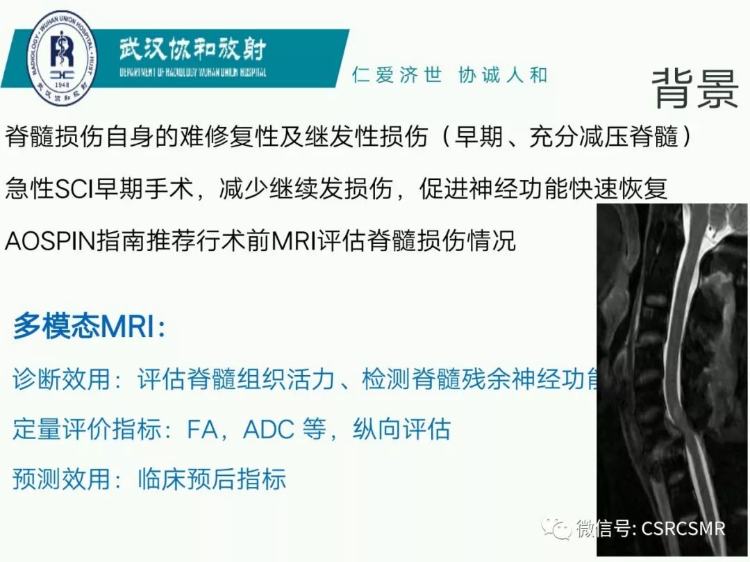 影像PPT - 【PPT】急性脊髓损伤--MR在临床决策和预后中的应用-10