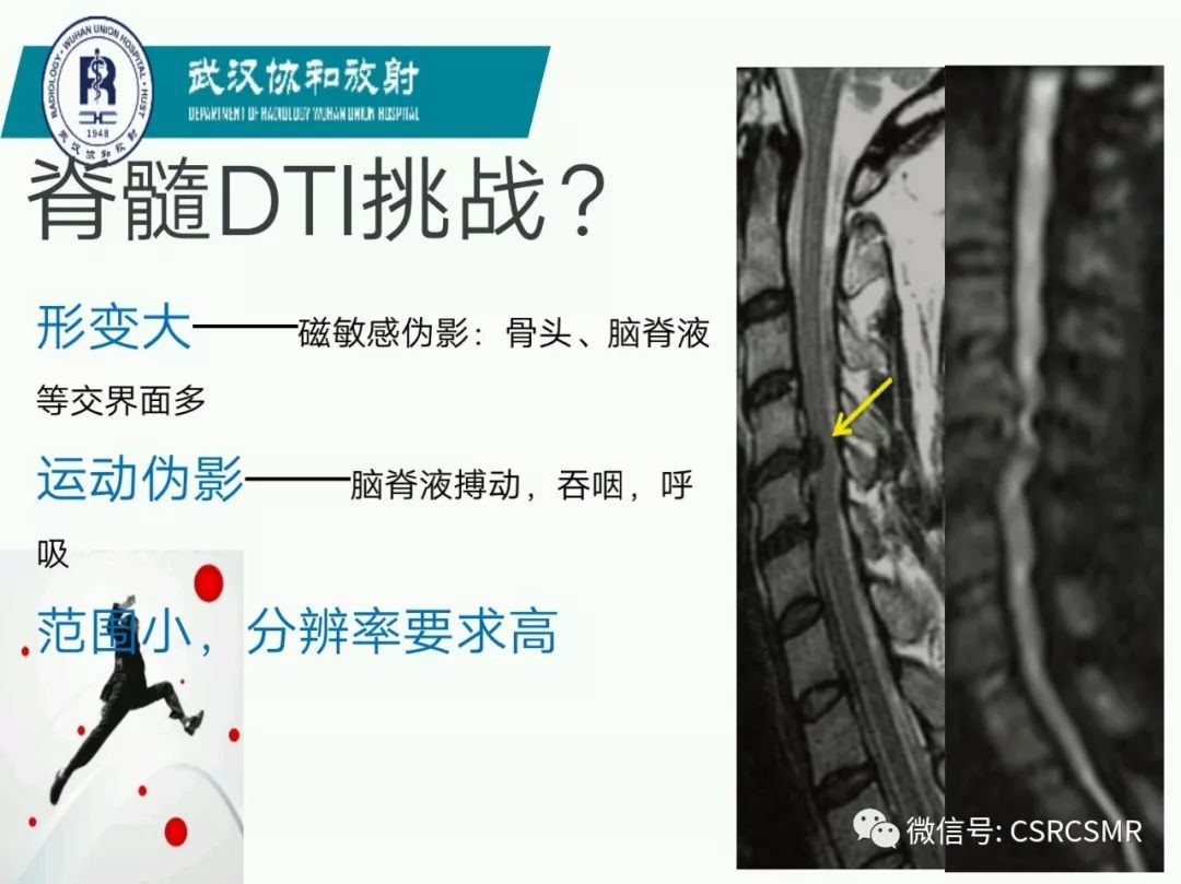 影像PPT - 【PPT】急性脊髓损伤--MR在临床决策和预后中的应用-12