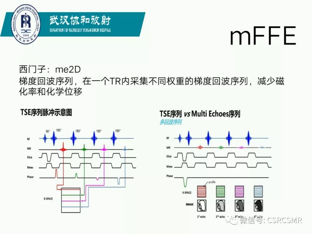 影像PPT - 【PPT】急性脊髓损伤--MR在临床决策和预后中的应用-15