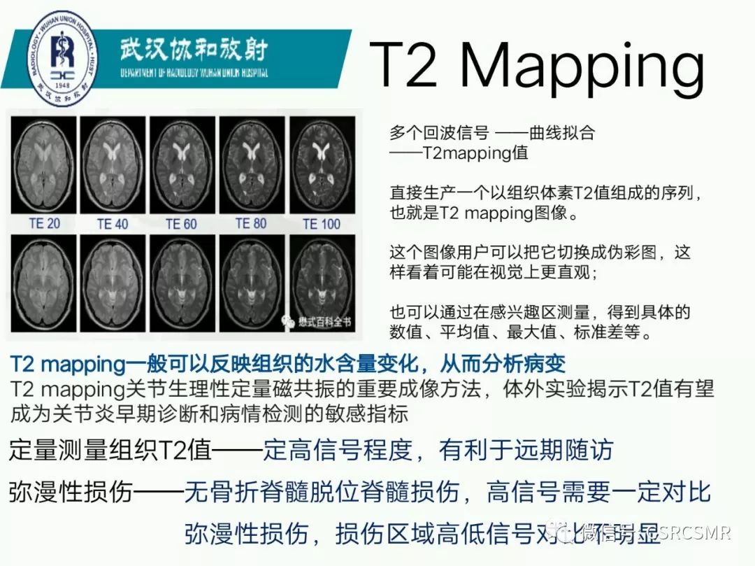 影像PPT - 【PPT】急性脊髓损伤--MR在临床决策和预后中的应用-18