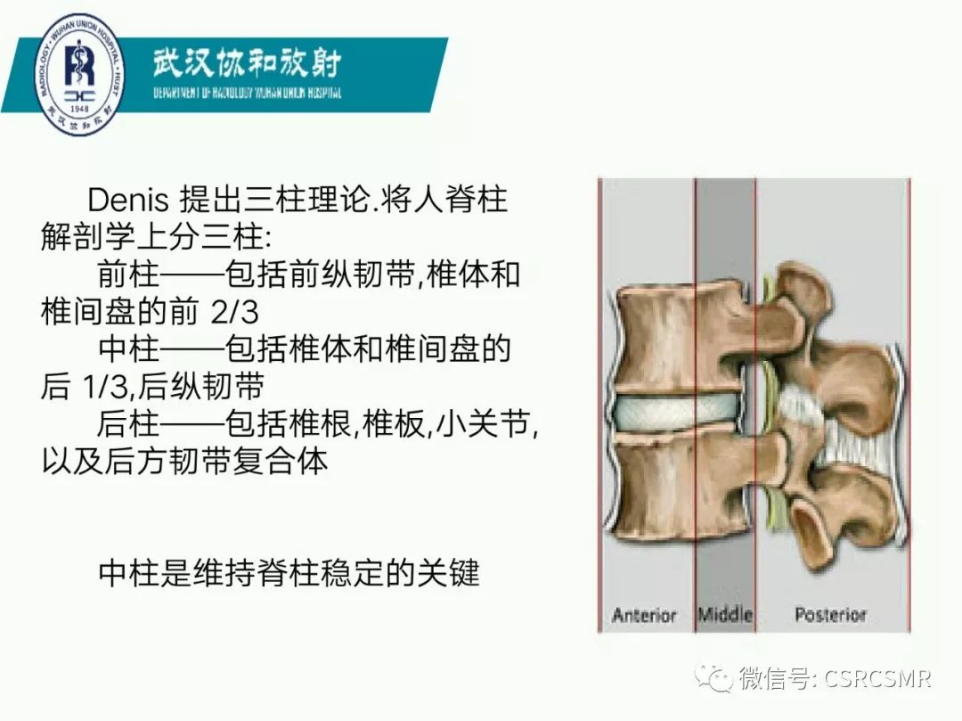 影像PPT - 【PPT】急性脊髓损伤--MR在临床决策和预后中的应用-34