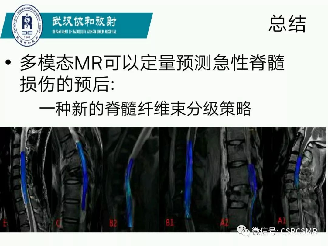 影像PPT - 【PPT】急性脊髓损伤--MR在临床决策和预后中的应用-67