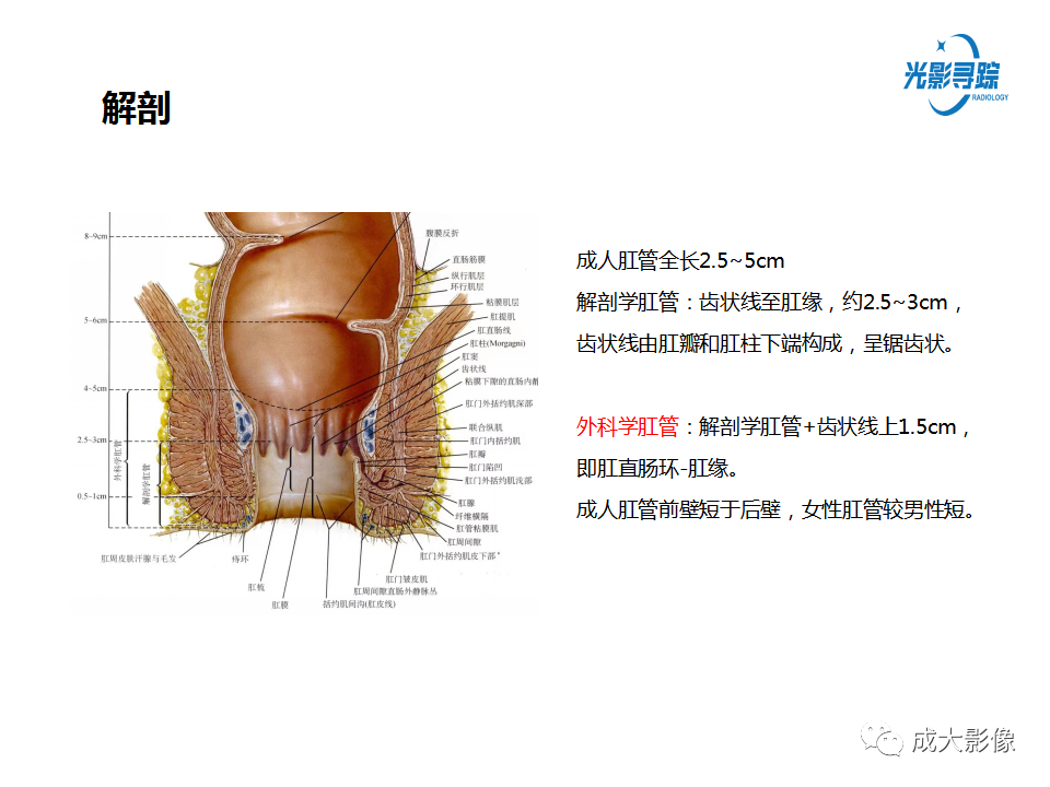 影像PPT - 【PPT】磁共振成像评估—肛周瘘的诊断：影像学特征谱-4