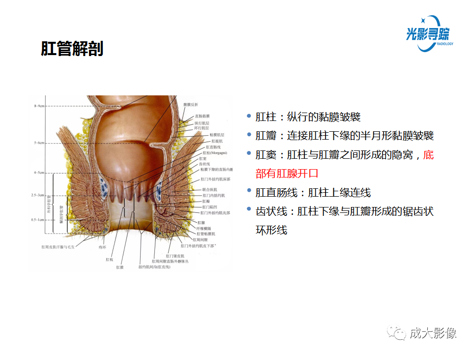 影像PPT - 【PPT】磁共振成像评估—肛周瘘的诊断：影像学特征谱-5
