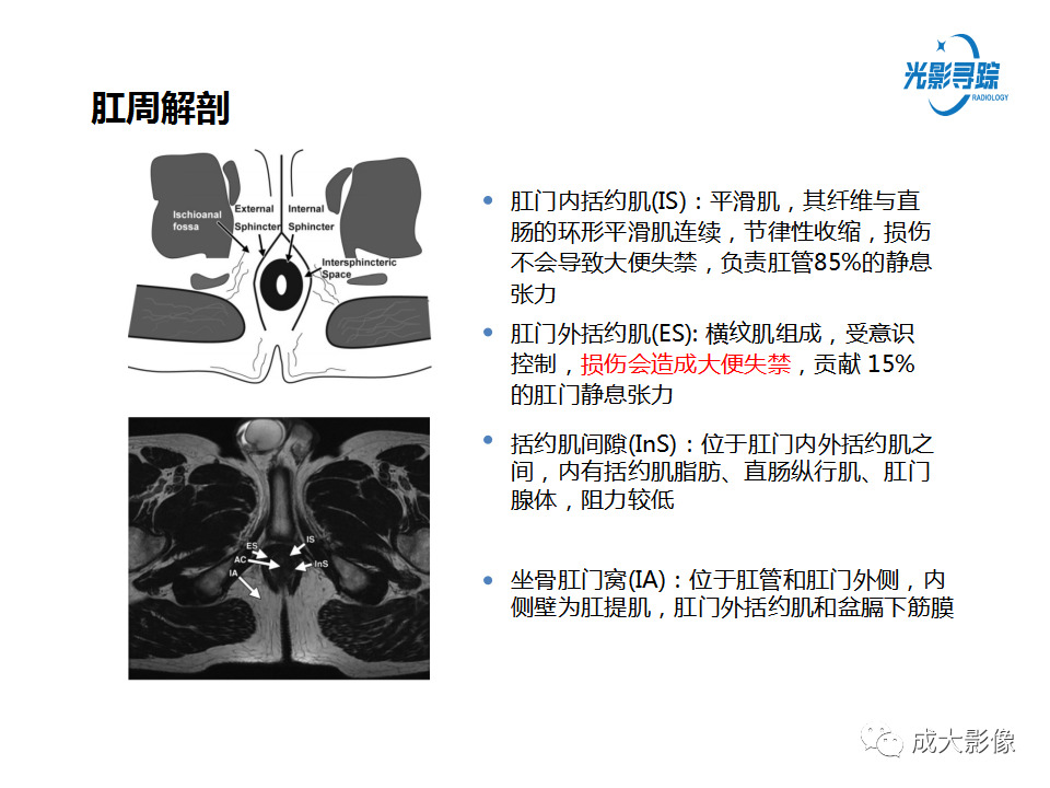 影像PPT - 【PPT】磁共振成像评估—肛周瘘的诊断：影像学特征谱-6