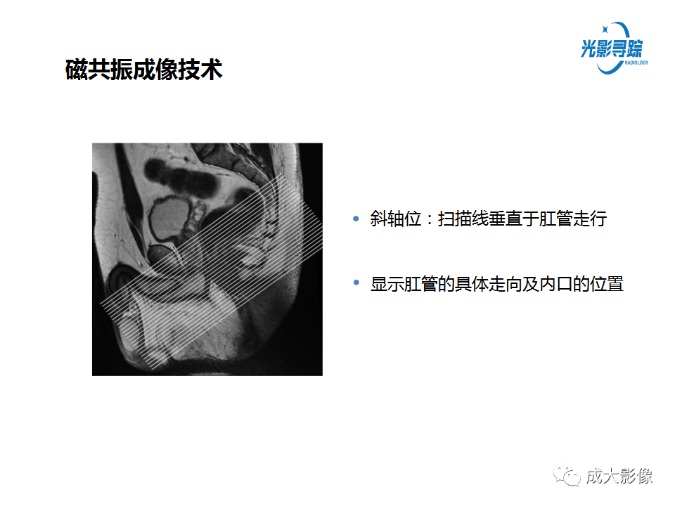 影像PPT - 【PPT】磁共振成像评估—肛周瘘的诊断：影像学特征谱-11