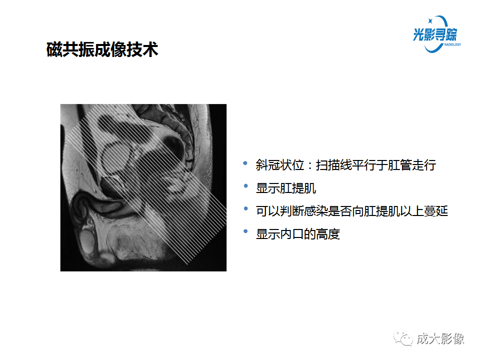影像PPT - 【PPT】磁共振成像评估—肛周瘘的诊断：影像学特征谱-12