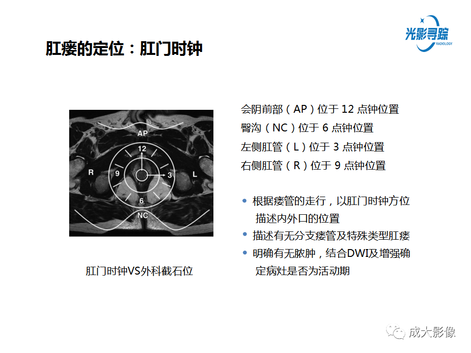 影像PPT - 【PPT】磁共振成像评估—肛周瘘的诊断：影像学特征谱-14