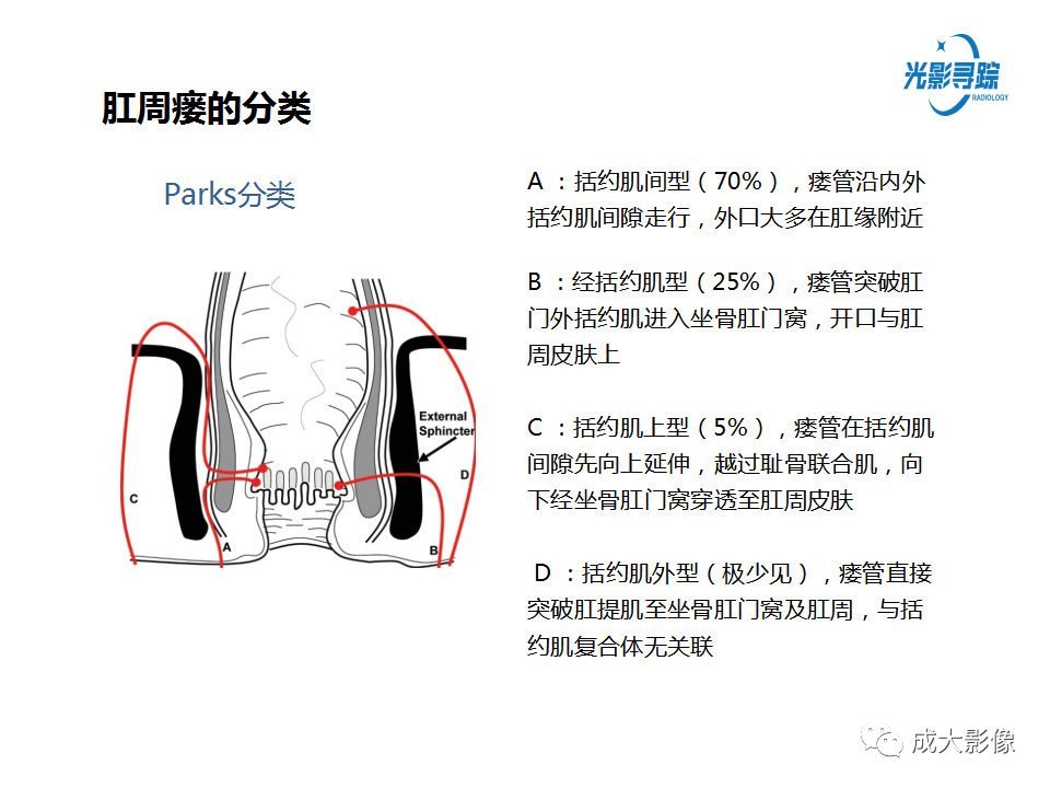 影像PPT - 【PPT】磁共振成像评估—肛周瘘的诊断：影像学特征谱-15