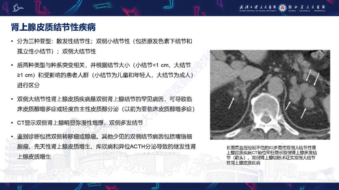 影像PPT - 【PPT】肾上腺肿瘤影像诊断-37