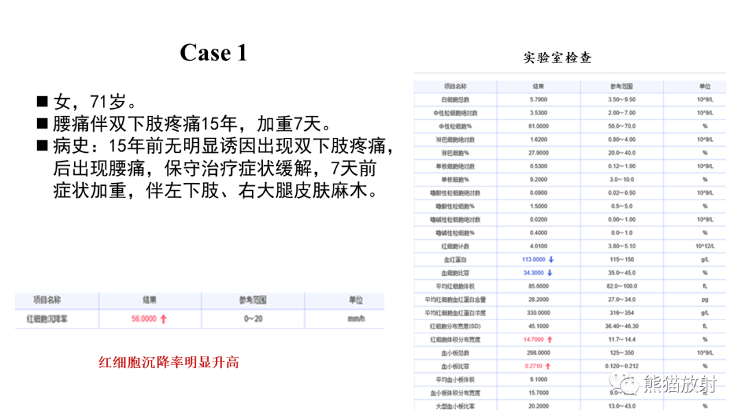 影像PPT - 【病例】布氏杆菌性脊柱炎2例CT及MR影像-2
