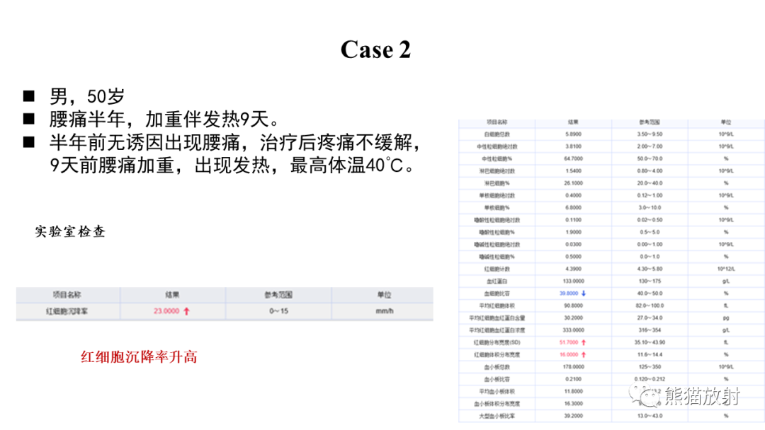 影像PPT - 【病例】布氏杆菌性脊柱炎2例CT及MR影像-9