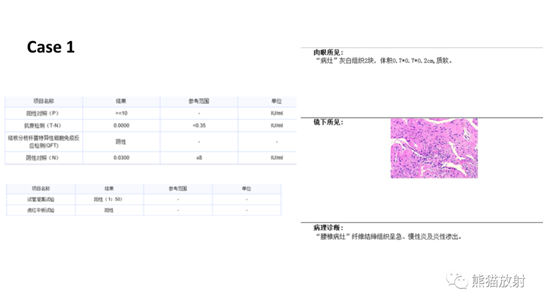 影像PPT - 【病例】布氏杆菌性脊柱炎2例CT及MR影像-15