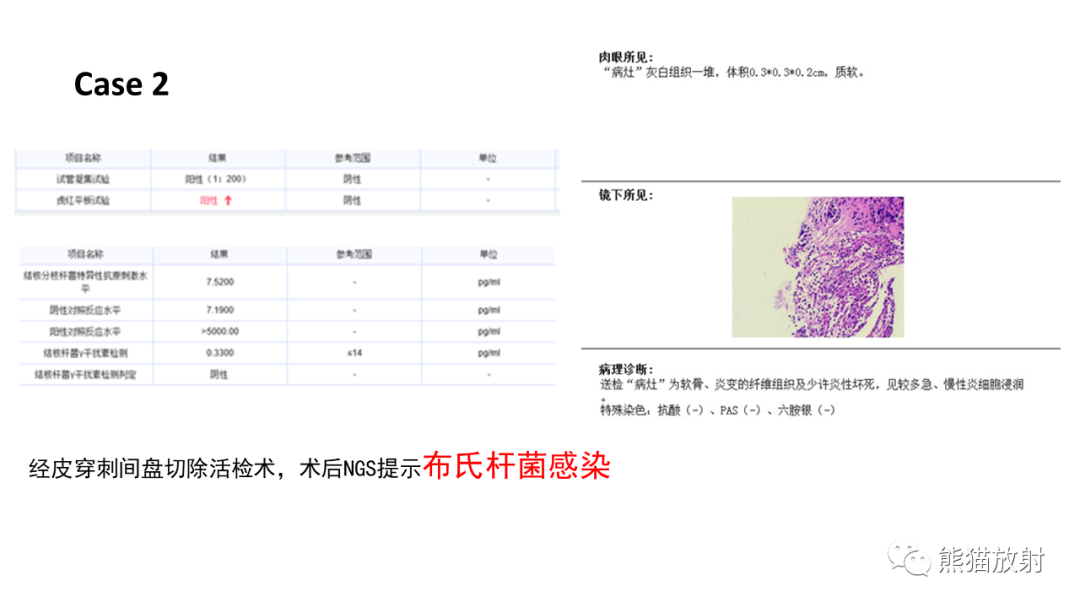 影像PPT - 【病例】布氏杆菌性脊柱炎2例CT及MR影像-16