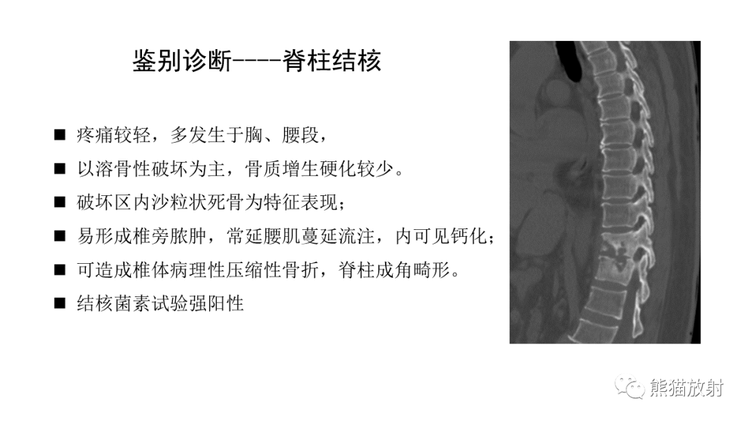 影像PPT - 【病例】布氏杆菌性脊柱炎2例CT及MR影像-27